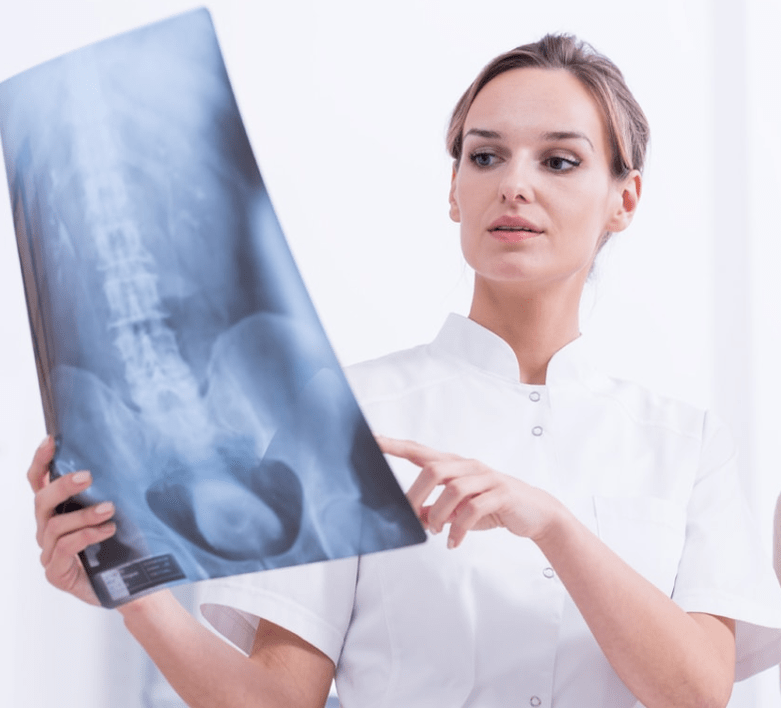 Diagnóis ar osteochondrosis thoracach trí scrúdú X-gha