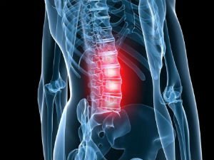 Osteochondrosis an spine lumbar